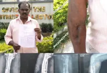 hand surgery negligence