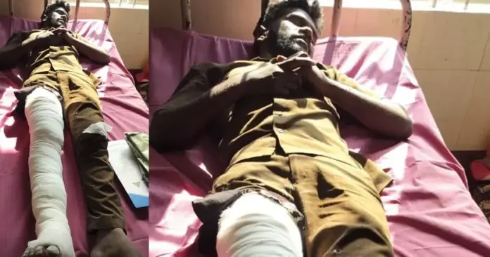 coimbatore burnt women news